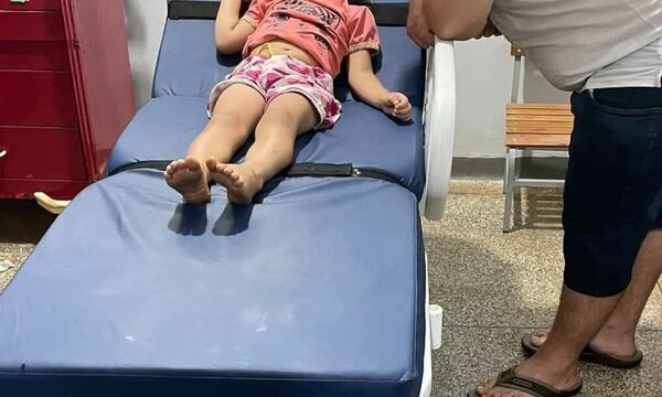 Niña tragó una moneda y bomberos la salvaron
