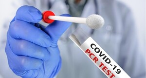 Pruebas PCR disponibles en el Hospital Regional de Encarnación para usuarios con orden médica