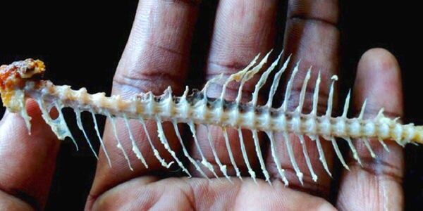 ENFERMERAS SE BURLARON DE UN JOVEN QUE TRAGÓ ESPINA DE PESCADO - La Voz del Norte