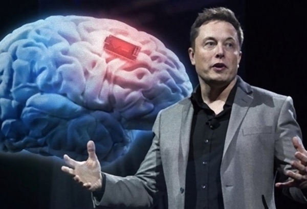 Elon Musk anunció primer implante de un chip cerebral inalámbrico | 1000 Noticias