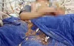 Parte del techo del Ineram cae sobre una paciente en terapia intensiva - Noticiero Paraguay
