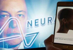 Elon Musk anuncia el primer implante de un chip en el cerebro de un humano