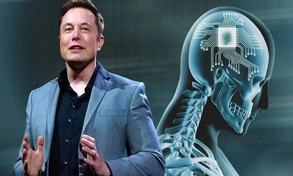 Elon Musk ya ha implementado el primer chip cerebral implantado a un ser humano
