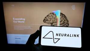 Neuralink: Elon Musk asegura que ya se implantó el primer chip cerebral en un ser humano - Ciencia - ABC Color
