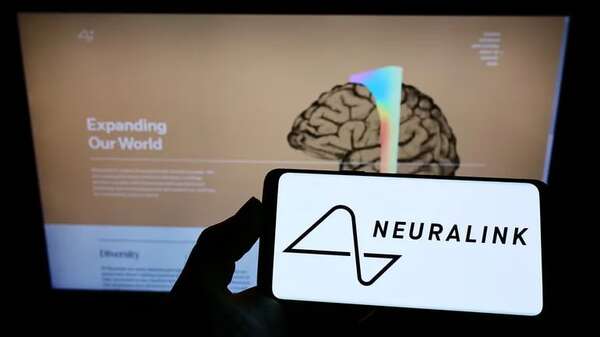 Neuralink: Elon Musk asegura que ya se implantó el primer chip cerebral en un ser humano - Ciencia - ABC Color