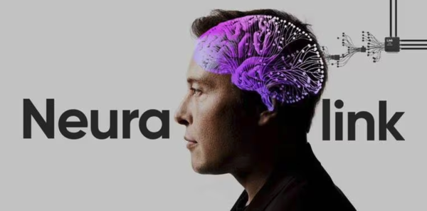 Elonk Musk anuncia el primer implante del chip "Neuralink" en el cerebro de un humano - El Trueno