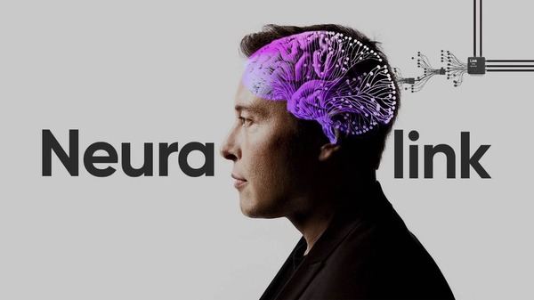 Por primera vez, Neuralink implantó un chip en el cerebro de un humano - Megacadena - Diario Digital