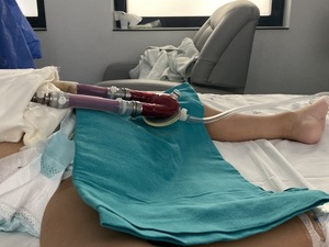 Una adolescente es conectada a corazón artificial a la espera del trasplante