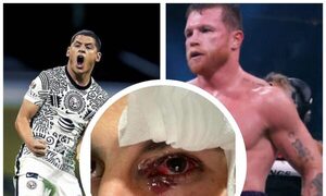 Piden que “Cachorro” Sánchez sea rival de famoso boxeador