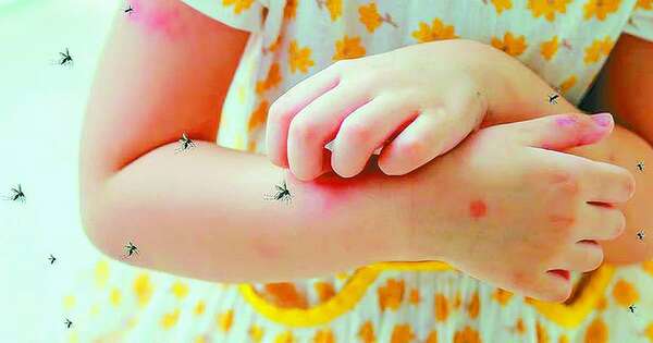 La Nación / Once niños fallecieron a consecuencia del dengue hasta la fecha, reportan desde el MSPyBS