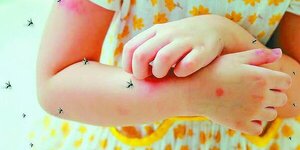 Once niños fallecieron a consecuencia del dengue hasta la fecha, reportan desde el MSPyBS