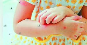 La Nación / Once niños fallecieron a consecuencia del dengue