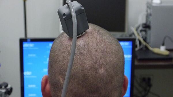 Comentan cómo funciona el chip cerebral implantado en un ser humano