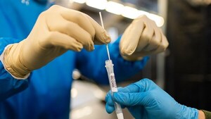 La OMS notifica más de 400.000 casos de Covid-19 en el mundo en las primeras semanas de 2024