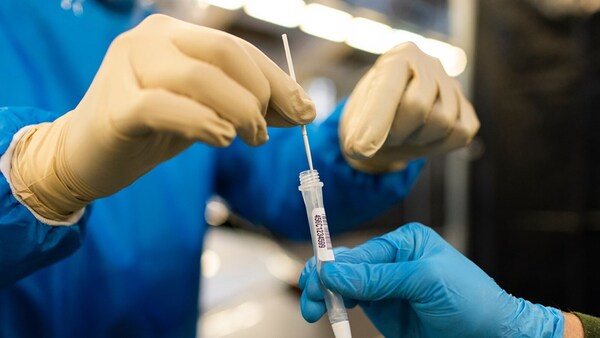 La OMS notifica más de 400.000 casos de Covid-19 en el mundo en las primeras semanas de 2024
