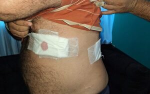 Imputan a Richard´i por asalto a sucursal de banco