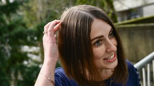 Una mujer recibe un inédito implante cerebral en Estados Unidos