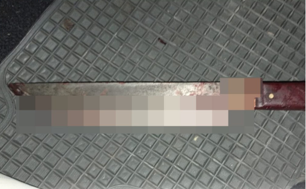 Hombre intentó degollar a su expareja con un cuchillo - Noticiero Paraguay