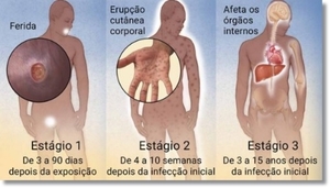 AUMENTAN CASOS DE SÍFILIS EN CDE - La Voz del Norte
