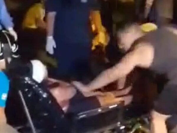 ASALTO EN PARQUE C.A.L: PROYECTIL ESTÁ INCRUSTADO EN EL PÓMULO DE LA JOVEN