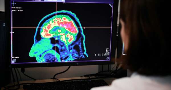 La Nación / Curan a niño de uno de los tumores cerebrales más mortales