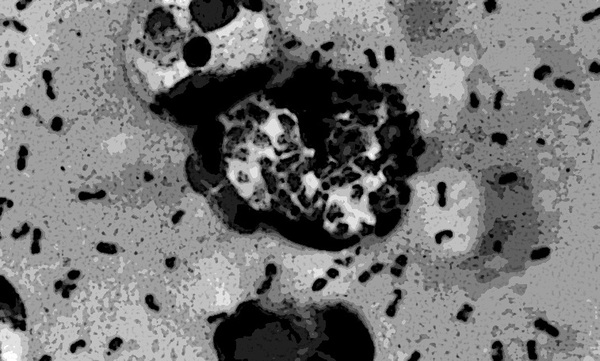 Estados Unidos confirma un caso de peste bubónica - ADN Digital