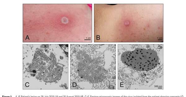 Diario HOY | ¿De qué se trata el virus de Alaska que enciende las alertas en Estados Unidos y el mundo?