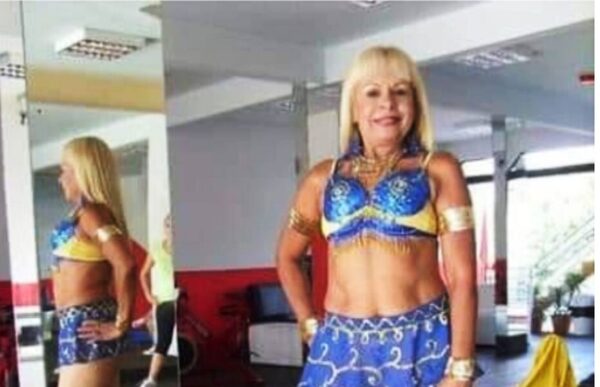 ¡”Abuela sexy” porrista de Luque fue mordida por un perro!