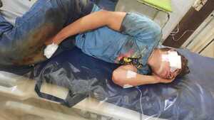 Balearon a un joven para robarle su motocicleta en Alto Verá