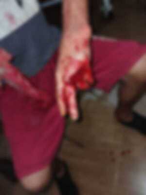 Enfrentamiento en gallinero deja a propietario herido