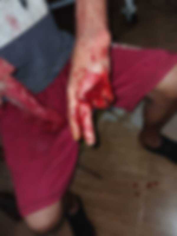 Enfrentamiento en gallinero deja a propietario herido