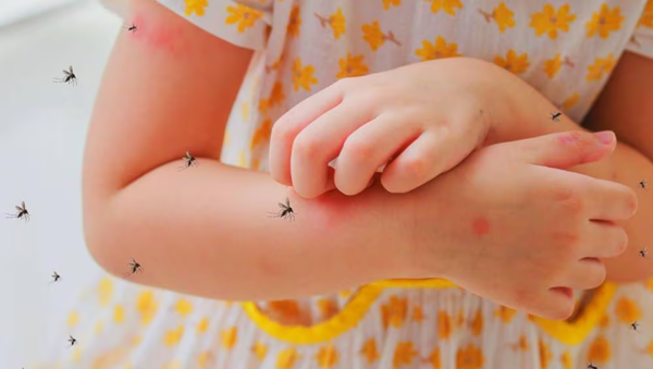 ¡Terrible! Pequeña de 9 años falleció a causa del dengue