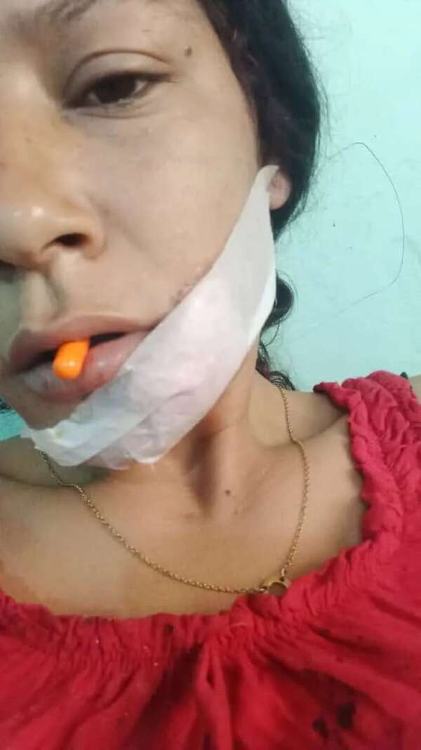 Víctima de reiterados hechos de violencia familiar teme por su vida - Nacionales - ABC Color