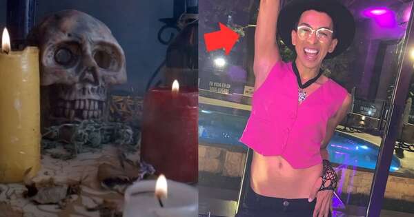 Diario HOY | Toñito Gaona casi se quedó sin dientes ¿le hicieron paye?