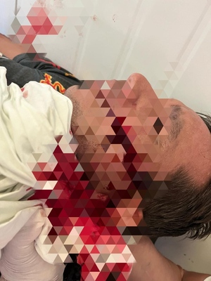 Con un machete, le cortó el rostro a su hermano durante una discusión