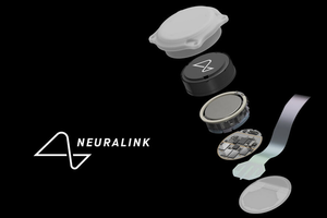 Primer paciente con chip cerebral de Neuralink puede controlar un mouse con la mente, afirmó Elon Musk - Megacadena - Diario Digital