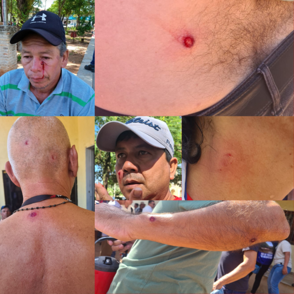 CON BALINES DE GOMA ATACAN A POBLADORES QUE SE MANIFIESTAN EN ARROYOS Y ESTEROS