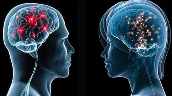 Sexología: “El cerebro es el órgano sexual por excelencia” - Estilo de vida - ABC Color