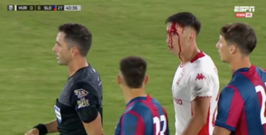 Versus / ¿Se pasó? Adam Bareiro ‘tajeó’ a un rival en el clásico ante Huracán