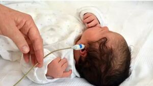 Recomiendan hacer test de la orejita a los bebés