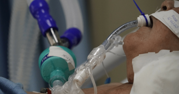 IPS informa que paciente que sufrió intento de extubación se encuentra estable - trece