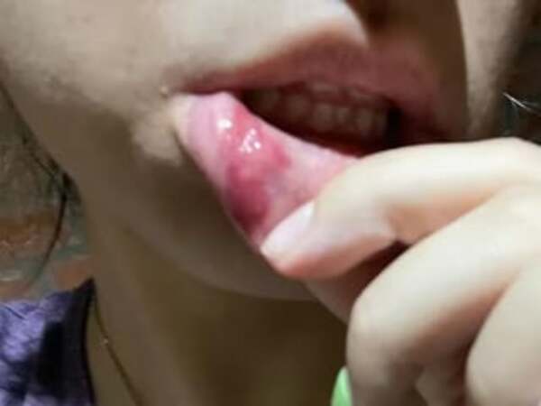 Joven denuncia que fue brutalmente golpeada por su novio pyahu