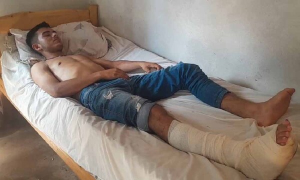 A garrotazos le roban su moto a un joven en Curuguaty – Prensa 5
