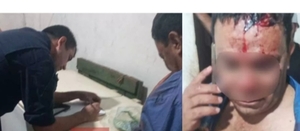 Karai fue reventado con un hierro por una pareja que exigió que apagara la música
