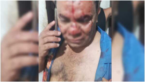 Confuso episodio en Itá Paso: Hombre denunció ser agredido y mujer ser víctima de robo