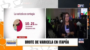 Salud observa brote de varicela en Itapúa - Noticias Paraguay