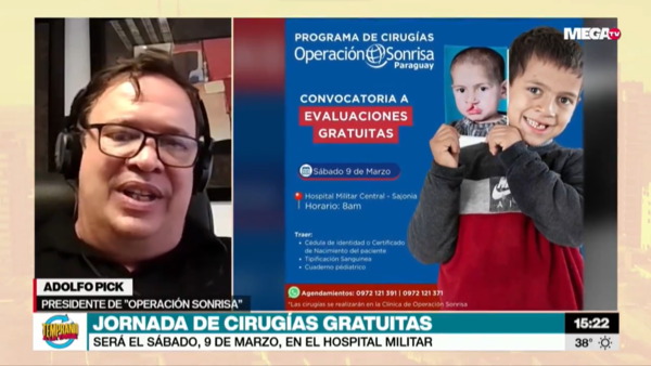 Operación Sonrisa: harán cirugías para 85 personas en el Hospital Militar - Megacadena - Diario Digital