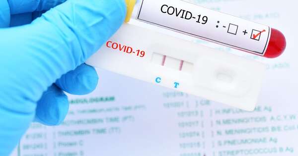 Diario HOY | El covid-19 podría empeorar las resacas