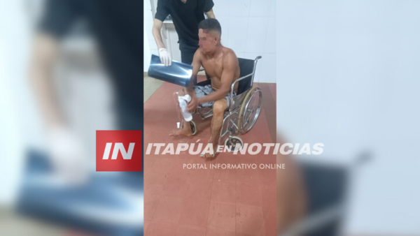 HOMBRE SE DISPARÓ EN LA CARA CON UN RIFLE Y SOBREVIVIÓ - Itapúa Noticias