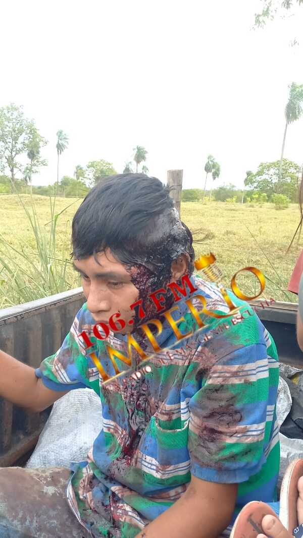 Joven indígena fue herido a machetazos en ronda de tragos - Radio Imperio 106.7 FM